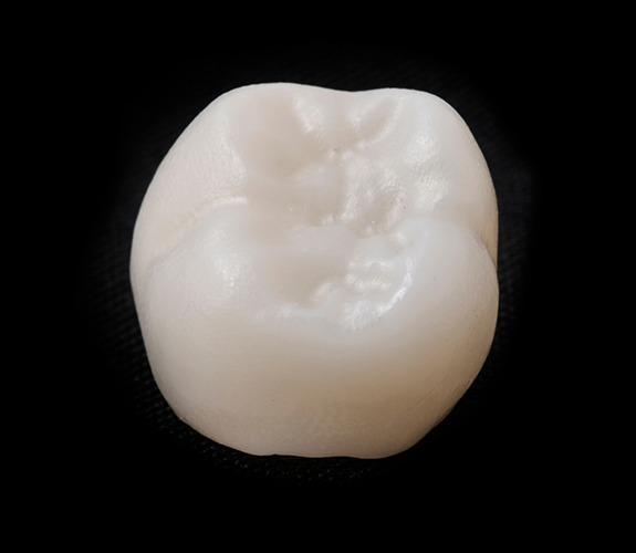 Close up of a dental crown