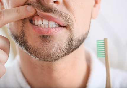 Man pointing to his gums