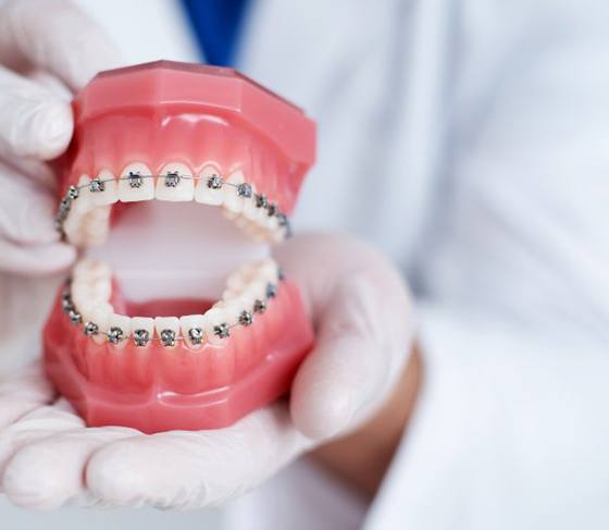 Dentist holding a dental model that has braces