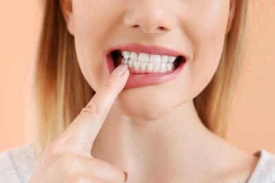 Woman pointing to teeth.